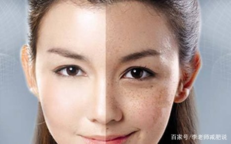 是什么原因引起脸上长斑？