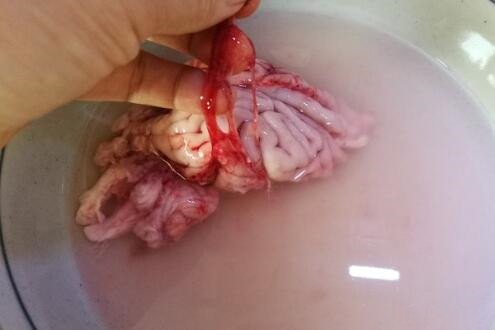 天麻炖猪脑有什么功效？