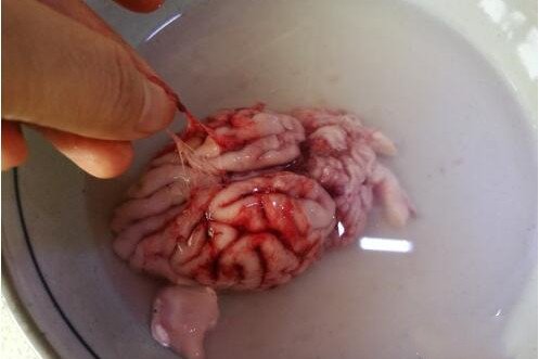 天麻炖猪脑有什么功效？