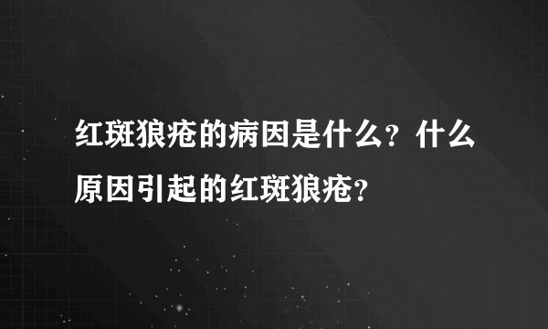 红斑狼疮的病因是什么？什么原因引起的红斑狼疮？