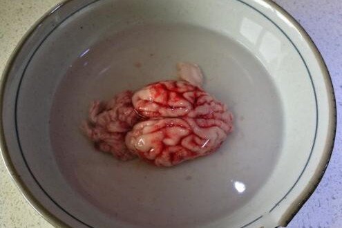 天麻炖猪脑有什么功效？