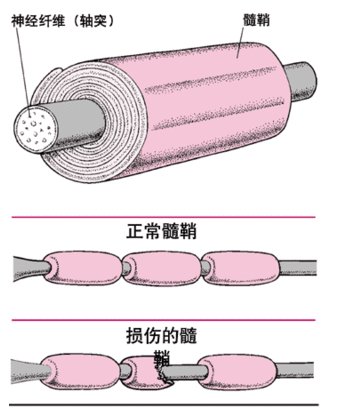 疼痛的级别的天下第一痛