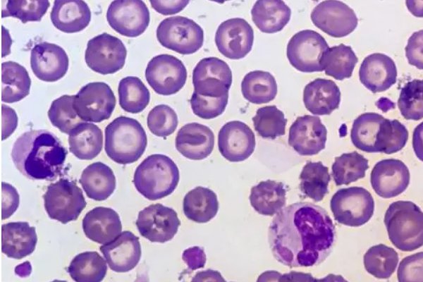 包涵体是什么意思