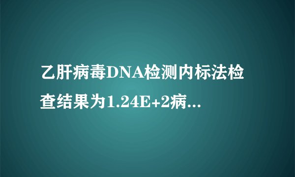 乙肝病毒DNA检测内标法检查结果为1.24E+2病毒量是什么意思