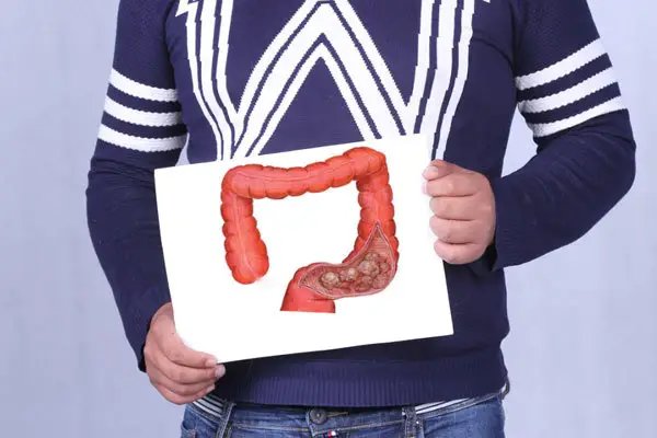 甘肃一家10口7人确诊肠癌，我们在平时生活中该如何预防这种疾病？