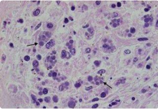包涵体名词解释