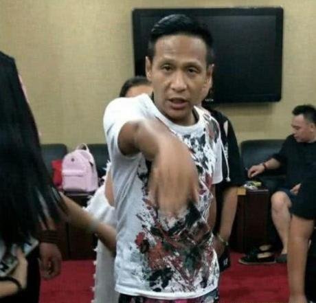 当众出丑的四位明星,第二位差点走光,最后一位失禁尿裤子,你知道是谁吗?