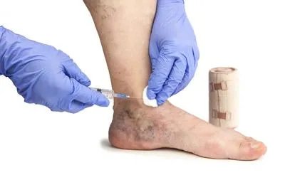 脚跟疼痛风的原因有哪些