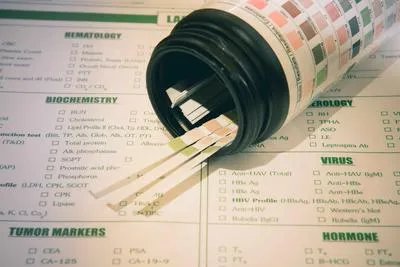 小舞蹈病怎么检查 盘点小舞蹈病的检查项目