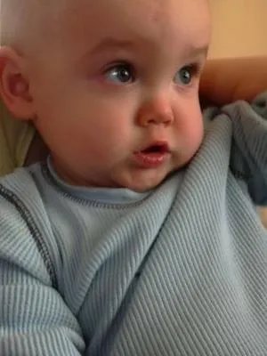 痱子形成的原因有哪些