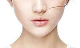 祛斑价钱是多少