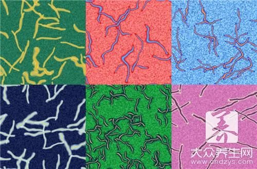 黄鳝寄生虫怎么杀死