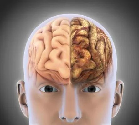 为什么会有皮质醇增多症