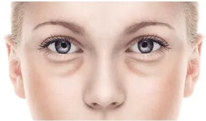 超声波去眼袋大概多少钱啊