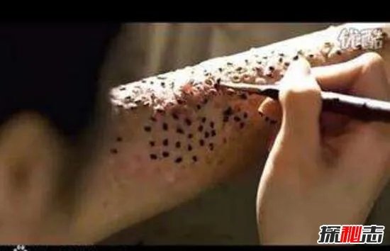 超恶心芝麻女孩的故事，芝麻镶进毛孔用牙签挑(图片/慎点)