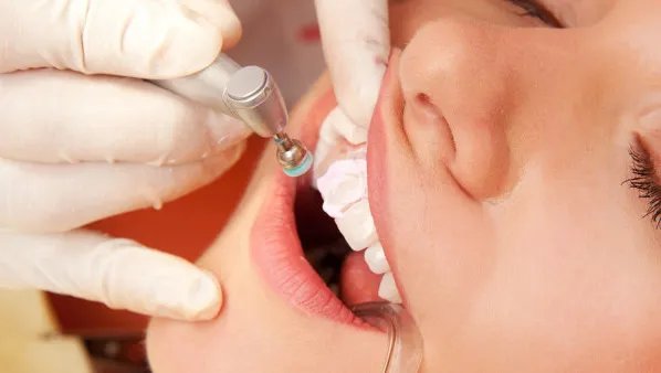 根管治疗的步骤