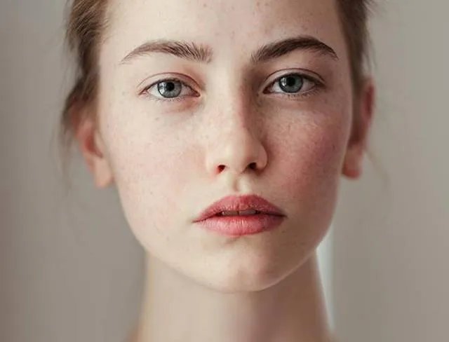 祛斑大概要多少钱