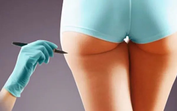 做吸脂减肥手术多少钱