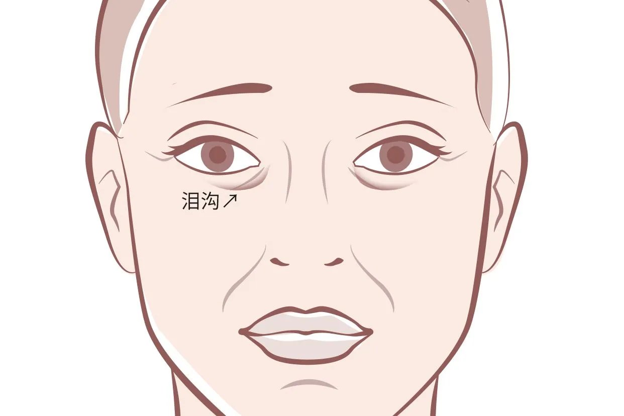 泪沟图片