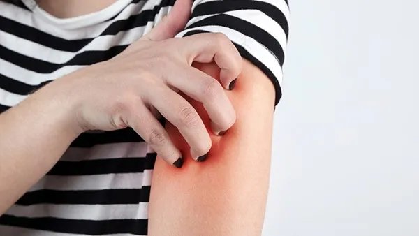 浑身痒是怎么回事