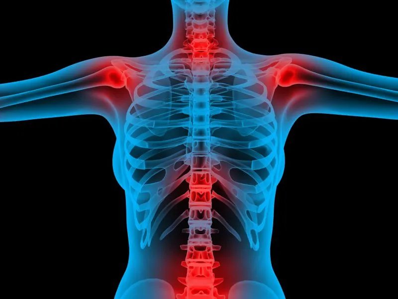 髂骨炎是什么原因