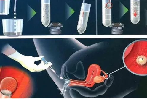 捐卵试管,三代试管生双胞胎-中山大学附属第一医院三代供供卵试管生男孩价格表(中山大学附属第二医院)