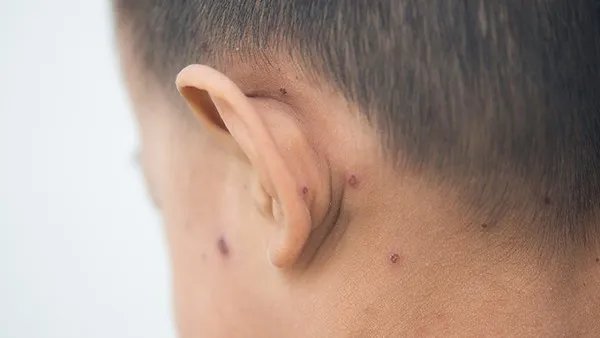 生长素的作用和效果