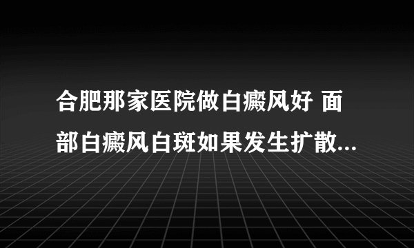 合肥那家医院做白癜风好 面部白癜风白斑如果发生扩散该怎么办？