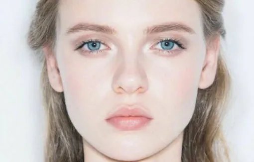 光子嫩肤去痘印价格