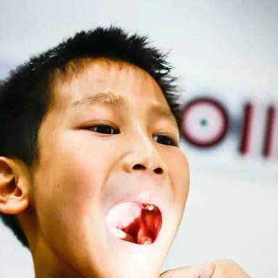 口腔鳞癌怎么治疗