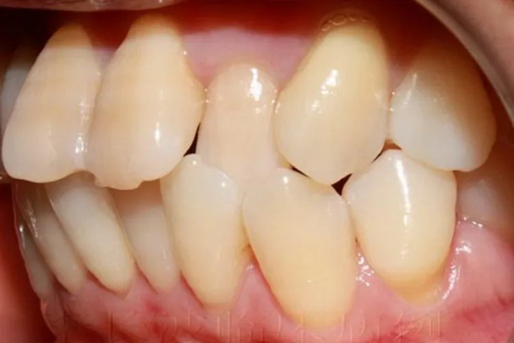 难看的牙齿图片大全