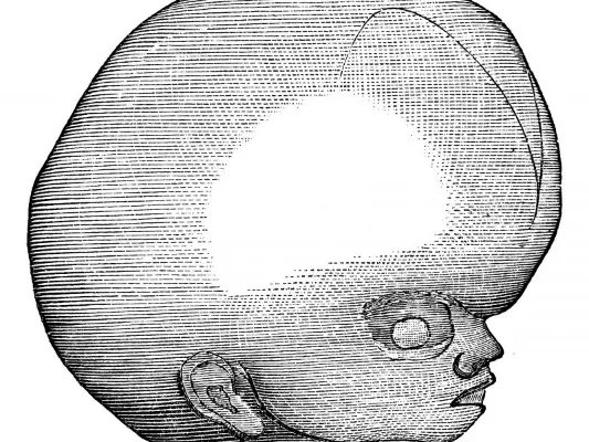 碳酸锂副作用的介绍