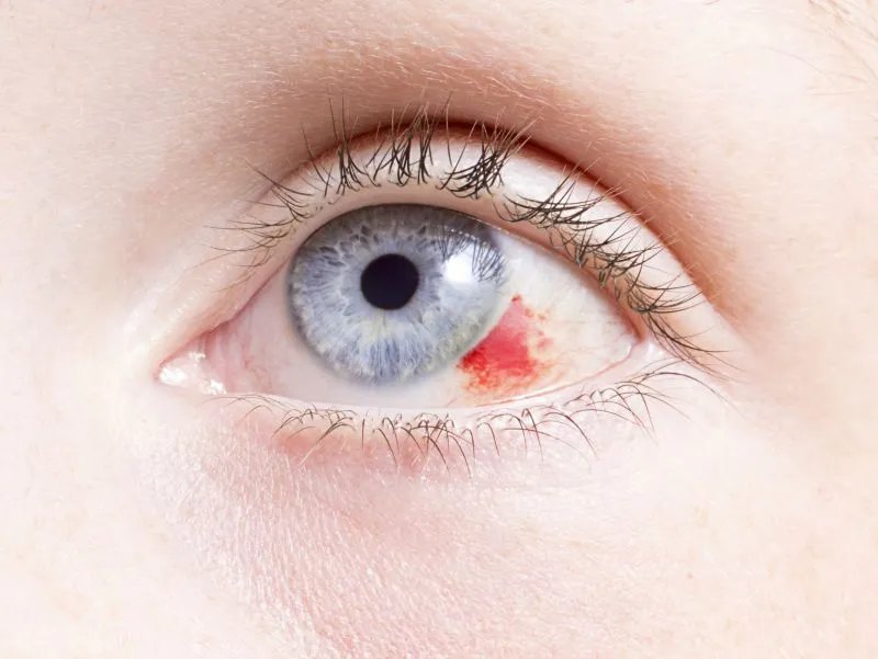 近视恢复训练的办法有什么