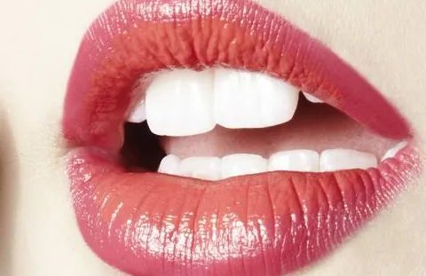 种植牙需要多少钱