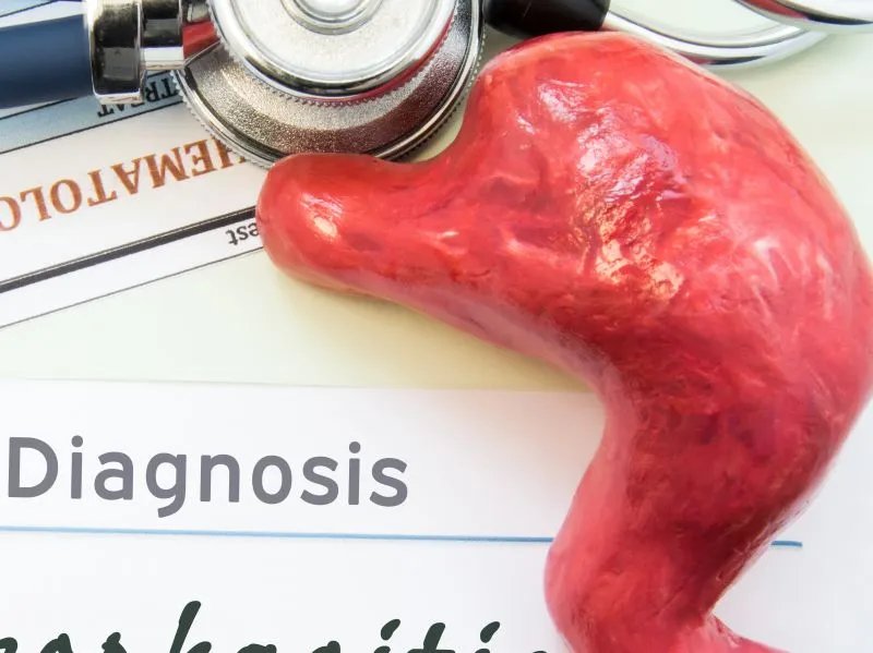 胃酸过多的原因