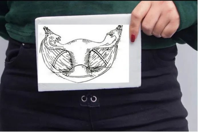 药流和人流哪个伤害小