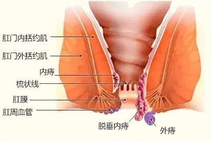肛门外有个肉疙瘩图片