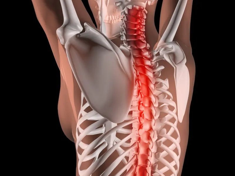 肋骨神经痛的严重后果