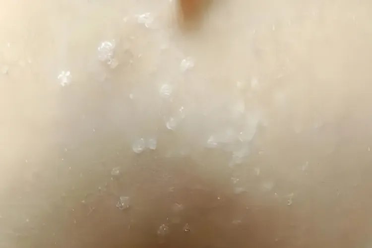 白色斑点初期症状图片