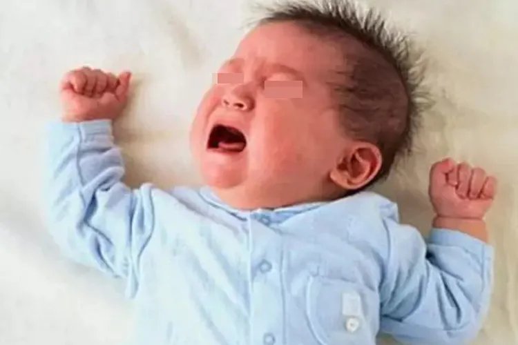 佝偻病儿童图片