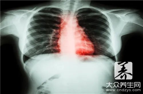  wpw综合症怎么治疗