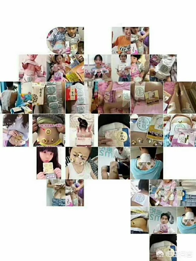 针灸推拿专业怎么样?