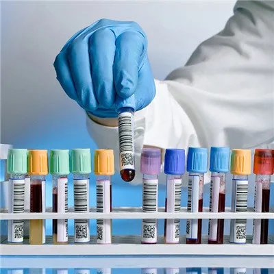 嗜血细胞综合症该如何治疗？