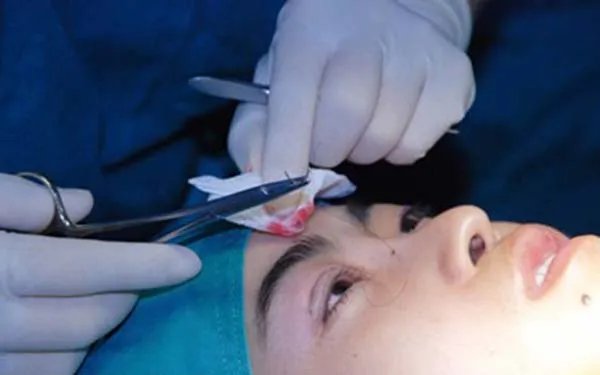 北京做双眼皮好的医院在哪里?