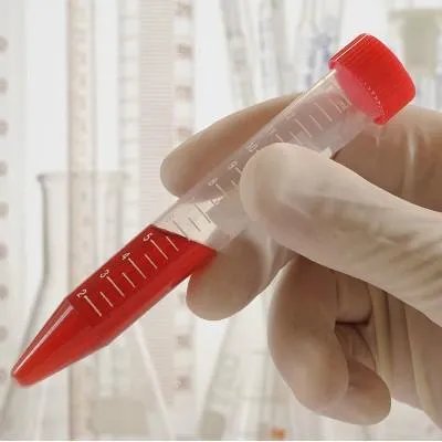 出血热能治好吗