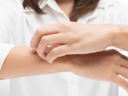 荨麻疹用什么药涂