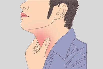 嗓子感觉有异物是新冠症状吗