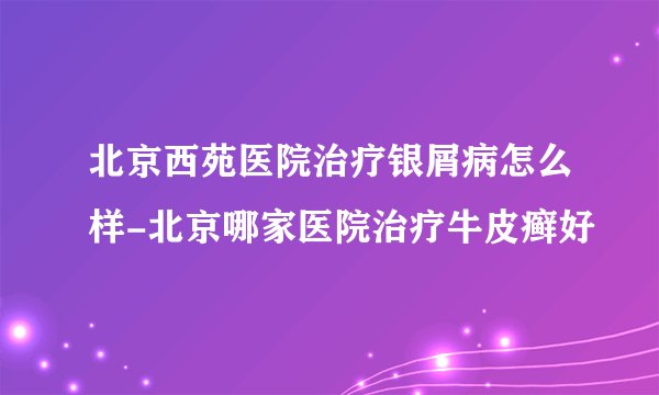 北京西苑医院治疗银屑病怎么样-北京哪家医院治疗牛皮癣好