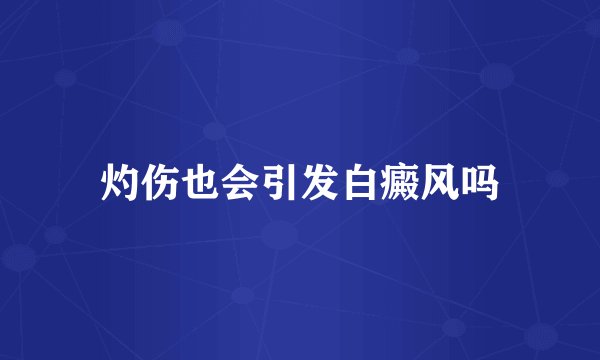 灼伤也会引发白癜风吗