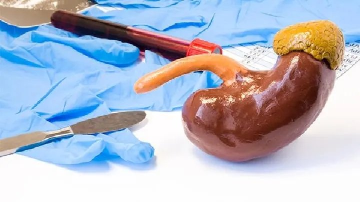 肾结石吃什么好?